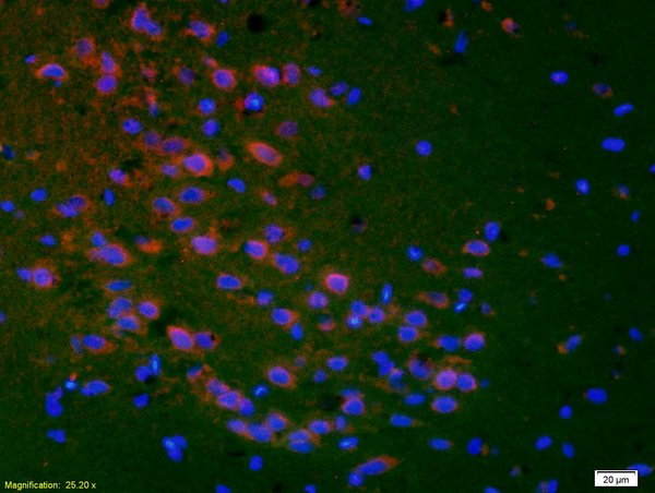 Formalin-fixed and paraffin embedded rat brain labeled with Anti-PTGER1 Polyclonal Antibody, Unconjugated (bs-6316R) at 1:200 followed by conjugation to the secondary antibody Goat Anti-Rabbit IgG, Cy3 conjugated(bs-0295G-Cy3) used at 1:200 dilution for 40 minutes at 37°C and DAPI staining