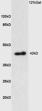 Lane 1: mouse kidney lysates probed with Anti PTGER1 Polyclonal Antibody, Unconjugated (bs-6316R) at 1:200 in 4˚C. Followed by conjugation to secondary antibody (bs-0295G-HRP) at 1:3000 90min in 37˚C. Predicted band 42kD. Observed band size: 42kD