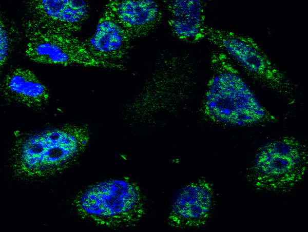 Image kindly submitted by Piotr Mamczur from Wroclaw University. Immunofluorescent localization of p53 protein in mouse squamous cell cancer (KLN-205 cell line) with BS-0033R antibody (1:50) and FITC-labeled secondary antibodies (1:2000). The nuclei were stained with DAPI.