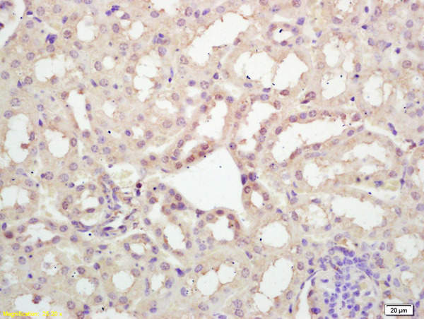 Formalin-fixed and paraffin embedded rat kidney labeled with Rabbit Anti KIF20A/MKLP2 Polyclonal Antibody, Unconjugated (bs-7750R) at 1:200 followed by conjugation to the secondary antibody and DAB staining