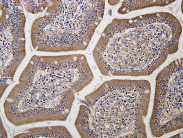 This image was kindly submitted by Dragos Scarlet DVM, MSc from the University of Vienna as part of the Bioss Discovery Progarm.\n\nParaffin embedded horse duodenum labeled with Anti-11ßHSD1 Polyclonal Antibody, Unconjugated (bs-3904R) at 1:200 followed by conjugation to the secondary antibody and DAB staining