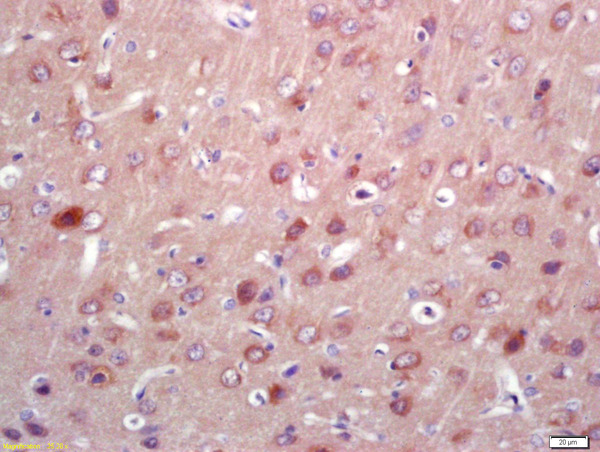 Formalin-fixed and paraffin embedded rat brain labeled with Anti-PNPO Polyclonal Antibody, Unconjugated (bs-5108R) at 1:200 followed by conjugation to the secondary antibody and DAB staining\n