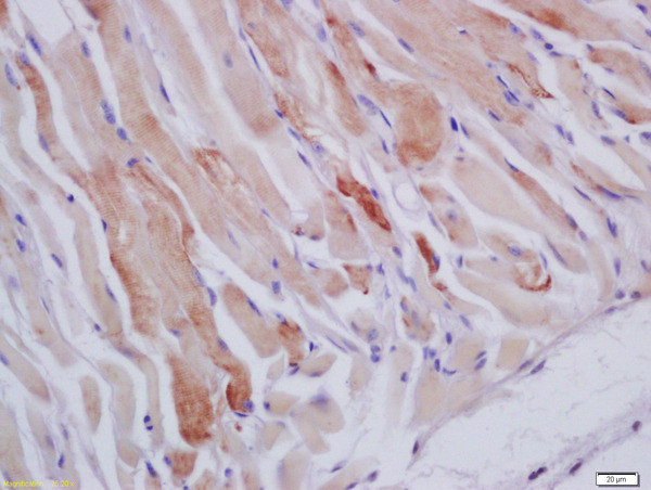 Formalin-fixed and paraffin embedded mouse stomach muscle labeled with Anti-HSPB7 Polyclonal Antibody, Unconjugated (bs-9430R) at 1:200 followed by conjugation to the secondary antibody and DAB staining