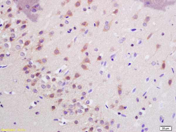 Formalin-fixed and paraffin embedded rat brain labeled with Anti-SHANK3 Polyclonal Antibody, Unconjugated (bs-12143R) at 1:200 followed by conjugation to the secondary antibody and DAB staining\\n