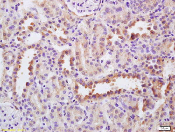 Formalin-fixed and paraffin embedded rat kidney labeled with Anti-EGF Polyclonal Antibody, Unconjugated (bs-2010R) at 1:200 followed by conjugation to the secondary antibody and DAB staining