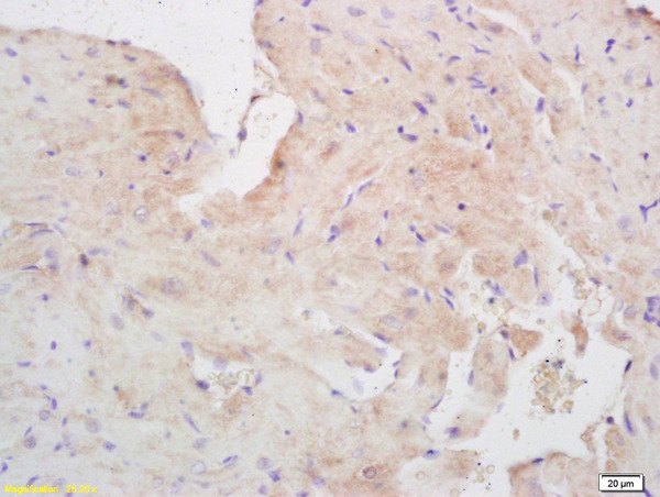 Formalin-fixed and paraffin embedded mouse heart labeled with Rabbit Anti Ninein/GSK3B interacting protein Polyclonal Antibody, Unconjugated (bs-7844R) at 1:200 followed by conjugation to the secondary antibody and DAB staining