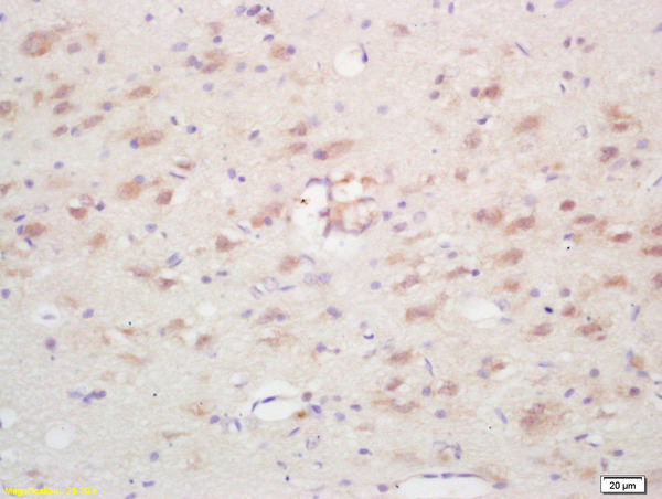 Formalin-fixed and paraffin embedded rat brain labeled with Rabbit Anti Ninein/GSK3B interacting protein Polyclonal Antibody, Unconjugated (bs-7844R) at 1:200 followed by conjugation to the secondary antibody and DAB staining