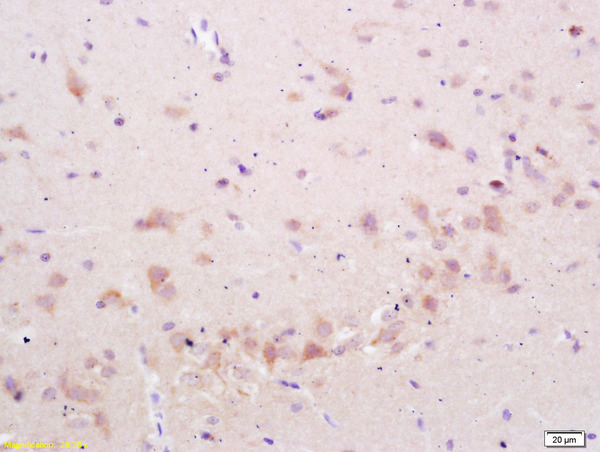 Formalin-fixed and paraffin embedded rat brain labeled with Anti-phospho-STMN2/SCG10 (Ser50) Polyclonal Antibody, Unconjugated (bs-2299R) at 1:200 followed by conjugation to the secondary antibody and DAB staining