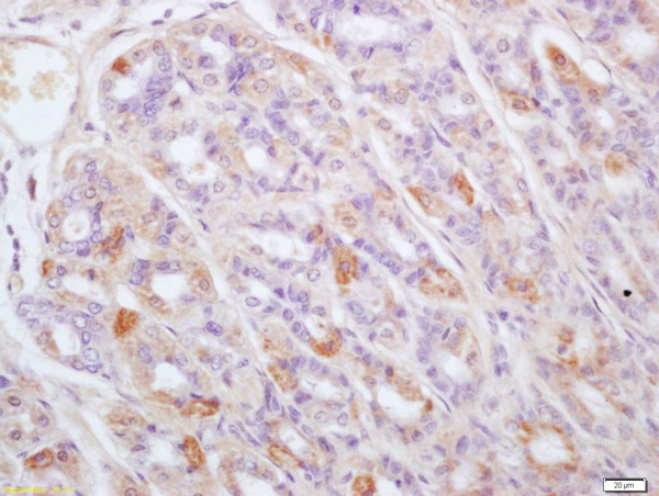 Formalin-fixed and paraffin embedded mouse stomach labeled with Anti-TPST1 Polyclonal Antibody, Unconjugated (bs-6850R) at 1:200 followed by conjugation to the secondary antibody and DAB staining Formalin-fixed and paraffin embedded mouse stomach labeled with Anti-TPST1 Polyclonal Antibody, Unconjugated (bs-6850R) at 1:200 followed by conjugation to the secondary antibody and DAB staining