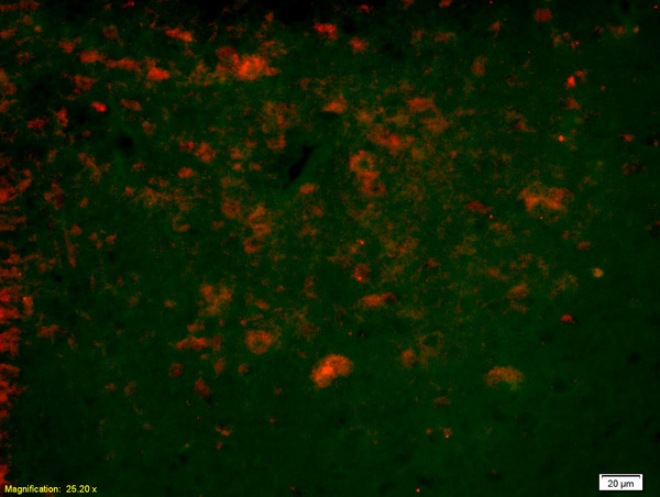 Formalin-fixed and paraffin-embedded rat brain labeled with Anti-Ninein/GSK3B interacting protein Polyclonal Antibody, Unconjugated(bs-7844R) 1:200, overnight at 4°C, The secondary antibody was Goat Anti-Rabbit IgG, Cy3 conjugated(bs-0295G-Cy3)used at 1:200 dilution for 40 minutes at 37°C.