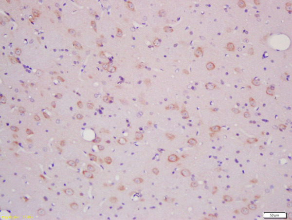 Formalin-fixed and paraffin embedded rat brain labeled with Anti-SLCO2B1/OATPB Polyclonal Antibody, Unconjugated (bs-3913R) at 1:200 followed by conjugation to the secondary antibody and DAB staining