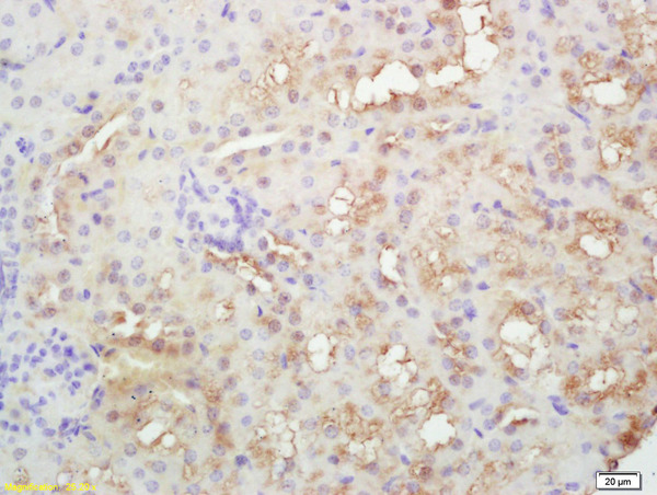 Formalin-fixed and paraffin embedded rat kidney labeled with Rabbit Anti PLEKHM2/SKIP Polyclonal Antibody, Unconjugated (bs-8063R) at 1:200 followed by conjugation to the secondary antibody and DAB staining