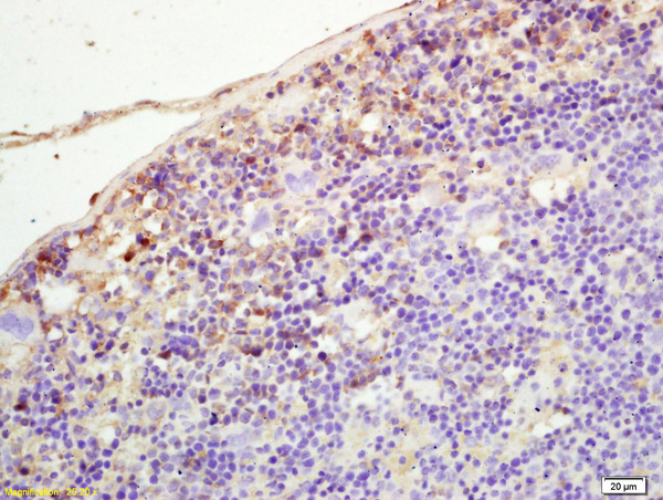 Formalin-fixed and paraffin embedded mouse spleen labeled with Rabbit Anti PLEKHM2/SKIP Polyclonal Antibody, Unconjugated (bs-8063R) at 1:200 followed by conjugation to the secondary antibody and DAB staining Formalin-fixed and paraffin embedded mouse spleen labeled with Rabbit Anti PLEKHM2/SKIP Polyclonal Antibody, Unconjugated (bs-8063R) at 1:200 followed by conjugation to the secondary antibody and DAB staining