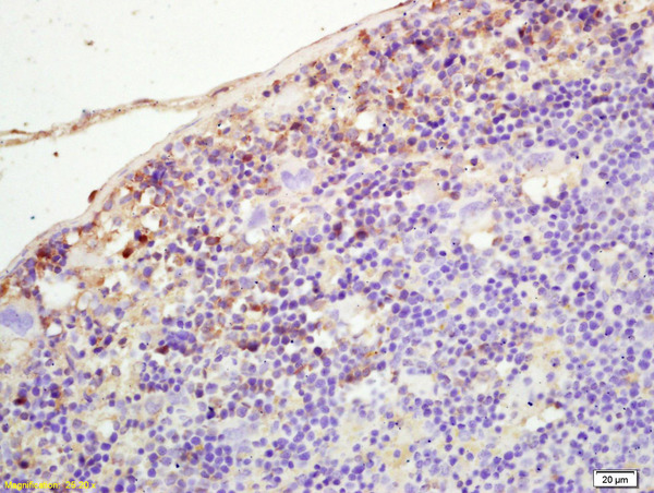 Formalin-fixed and paraffin embedded mouse spleen labeled with Rabbit Anti PLEKHM2/SKIP Polyclonal Antibody, Unconjugated (bs-8063R) at 1:200 followed by conjugation to the secondary antibody and DAB staining
