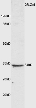 Mouse lung lysate probed with Anti CTLA4 Polyclonal Antibody, Unconjugated (bs-10006R) at 1:200 overnight at 4˚C. Followed by conjugation to secondary antibody (bs-0295G-HRP) at 1:3000 for 90 min at 37˚C. Predicted band 34kD. Observed band size: 34kD
