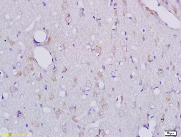 Formalin-fixed and paraffin embedded rat brain tissue labeled with Anti-CLEC1/CLEC1A Polyclonal Antibody, Unconjugated (bs-2542R) at 1:200 followed by conjugation to the secondary antibody and DAB staining\n