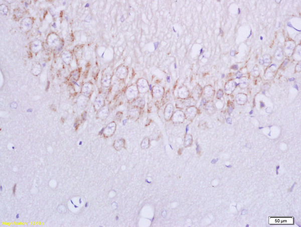 Formalin-fixed and paraffin embedded rat brain labeled with Anti-Plexin B1 Polyclonal Antibody, Unconjugated (bs-2693R) at 1:200 followed by conjugation to the secondary antibody and DAB staining
