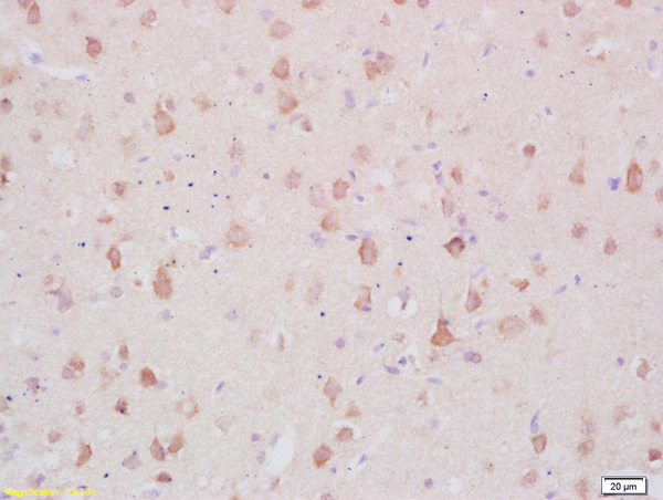 Formalin-fixed and paraffin embedded rat brain labeled with Anti-MARCKS Polyclonal Antibody, Unconjugated (bs-2909R) at 1:200 followed by conjugation to the secondary antibody and DAB staining