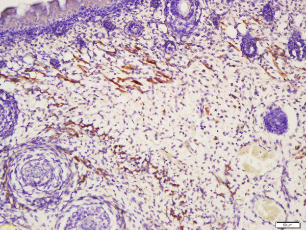 Formalin-fixed and paraffin embedded muscle of mouse embryo labeled with Anti-TAGL2 Polyclonal Antibody, Unconjugated (bs-2977R) at 1:200 followed by conjugation to the secondary antibody and DAB staining\n