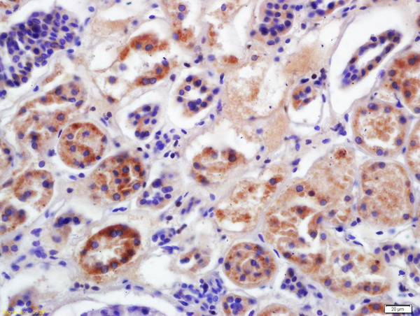 Formalin-fixed and paraffin embedded human kidney labeled with Anti-CYP2D6 Polyclonal Antibody, Unconjugated (bs-2991R) at 1:200 followed by conjugation to the secondary antibody and DAB staining