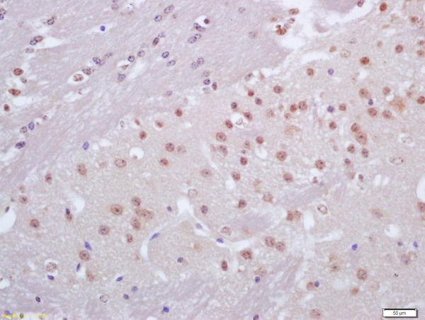 Formalin-fixed and paraffin embedded mouse brain labeled with Anti-CRX1 Polyclonal Antibody, Unconjugated (bs-3798R) at 1:200 followed by conjugation to the secondary antibody and DAB staining
