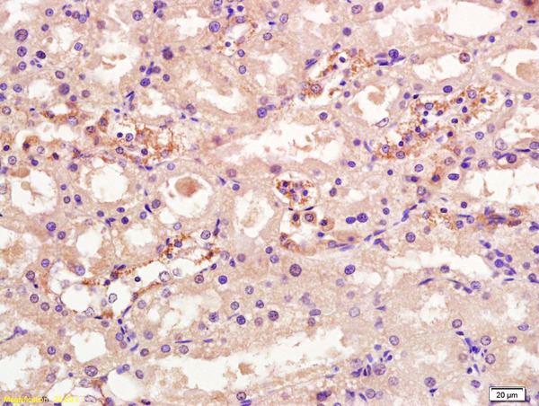 Formalin-fixed and paraffin embedded rat kidney labeled with Rabbit Anti OSTM1 Polyclonal Antibody, Unconjugated (bs-8506R) at 1:200 followed by conjugation to the secondary antibody and DAB staining