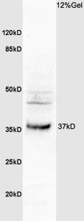 L1 human colon carcinoma lysates probed with Anti OSTM1 Polyclonal Antibody, Unconjugated (bs-8506R) at 1:200 overnight at 4˚C. Followed by conjugation to secondary antibody (bs-0295G-HRP) at 1:3000 for 90 min at 37˚C. Predicted band 37kD. Observed band size:37kD.\n