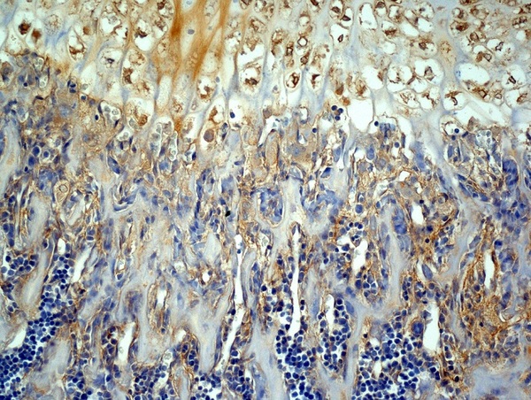 Generously provided by Markus Linder from Medical University Vienna as part of the Bioss Discovery Program. Formalin-fixed, paraffin embedded, and decalcified in EDTA mouse bone labeled with Anti-MMP-13 Polyclonal Antibody, Unconjugated (bs-0575R) at 1:200 followed by conjugation to the secondary antibody and DAB staining