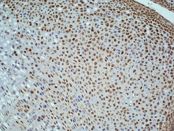Generously provided by Markus Linder from Medical University Vienna as part of the Bioss Discovery Program. Formalin-fixed, paraffin embedded, and decalcified in EDTA embryonic mouse bone labeled with Anti-Ki-67 (Proliferation Marker) Polyclonal Antibody, Unconjugated (bs-2130R) at 1:100 followed by conjugation to the secondary antibody and DAB staining