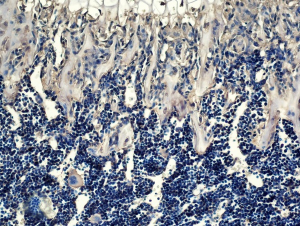 Generously provided by Markus Linder from Medical University Vienna as part of the Bioss Discovery Program. Formalin-fixed, paraffin embedded, and decalcified in EDTA mouse bone labeled with Anti-OPG Polyclonal Antibody, Unconjugated (bs-0431R) at 1:100 followed by conjugation to the secondary antibody and DAB staining
