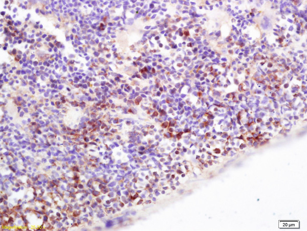 Formalin-fixed and paraffin embedded mouse spleen labeled with  Rabbit Anti CD36\/PAS-4  Polyclonal Antibody, Unconjugated (bs-8873R) at 1:200 followed by conjugation to the secondary antibody and DAB staining