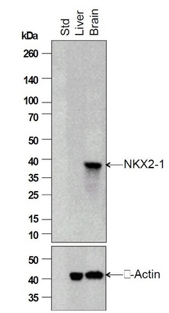 Independently Validated Antibody, image provided by Science Direct, badge number 028752. Western blot analysis of mouse brain and liver extracts using NK2 Homeobox 1 (bs-0826R NKX2-1) antibody, 1:500 dilution. NKX2-1 is present in the positive control sample (brain) and absent from the negative control sample (liver). The predicted and observed position of NKX2-1 is at around 38kDa.