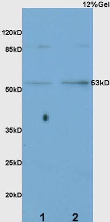 L1 mouse intestine lysates L2 rat lung lysates probed with Anti CD36\/PAS-4  Polyclonal Antibody, Unconjugated (bs-8873R) at 1:200 overnight at 4˚C. Followed by conjugation to secondary antibody (bs-0295G-HRP) at 1:3000 for 90 min at 37˚C. Predicted band 5kD. Observed band size:41kD.\\n