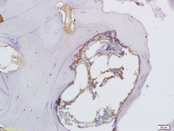 Formalin-fixed and paraffin embedded rat shin bone labeled with Anti-Osteopontin Polyclonal Antibody, Unconjugated (bs-0026R) at 1:300 followed by conjugation to the secondary antibody and DAB staining\n