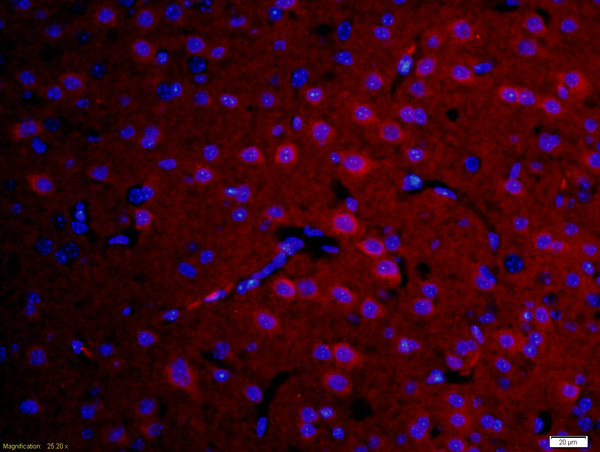 Formalin-fixed and paraffin-embedded rat brain labeled with Anti-DFFB Polyclonal Antibody, Unconjugated(bs-0043R) 1:200, overnight at 4°C, The secondary antibody was Goat Anti-Rabbit IgG, Cy3 conjugated(bs-0295G-Cy3)used at 1:200 dilution for 40 minutes at 37°C.n