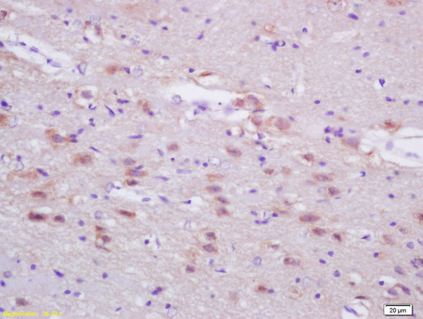 Formalin-fixed and paraffin embedded rat brain labeled with Anti-ASN/Fatty Acid Synthase 1 Polyclonal Antibody, Unconjugated (bs-1498R)at 1:200, followed by conjugation to the secondary antibody and DAB staining