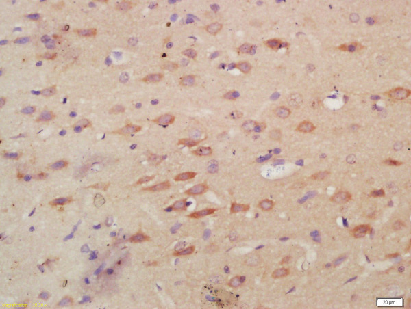 Formalin-fixed and paraffin embedded rat brain labeled with Anti-MPO Polyclonal Antibody, Unconjugated (bs-4943R) at 1:200, followed by conjugation to the secondary antibody and DAB staining