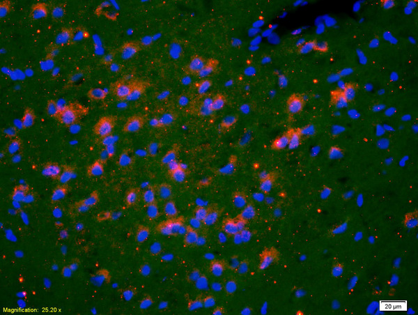 Formalin-fixed and paraffin-embedded rat brain labeled with Anti-TSHR Polyclonal Antibody, Unconjugated(bs-0003R) 1:200, overnight at 4°C, The secondary antibody was Goat Anti-Rabbit IgG, Cy3 conjugated(bs-0295G-Cy3)used at 1:200 dilution for 40 minutes at 37°C.