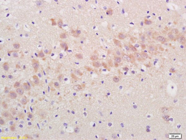 Formalin-fixed and paraffin embedded rat brain labeled with Rabbit Anti Annexin A13 Polyclonal Antibody, Unconjugated (bs-0055R) at 1:200 followed by conjugation to the secondary antibody and DAB staining