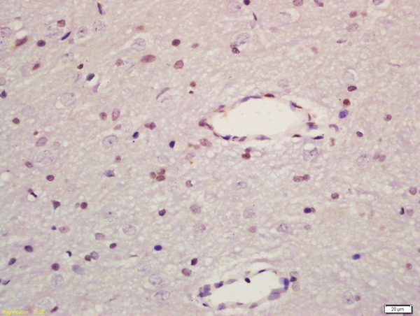 Formalin-fixed and paraffin embedded rat brain labeled with Anti-MAPK8IP1 Polyclonal Antibody, Unconjugated (bs-6255R) at 1:200 followed by conjugation to the secondary antibody and DAB staining