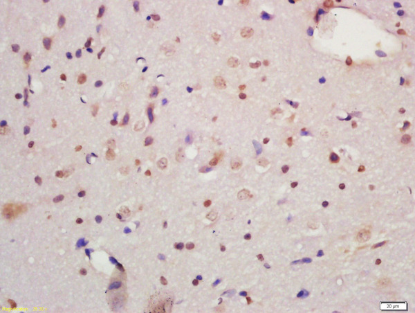 Formalin-fixed and paraffin embedded rat brain labeled with Anti-MAPK organizer 1 Polyclonal Antibody, Unconjugated (bs-6722R) at 1:200 followed by conjugation to the secondary antibody and DAB staining