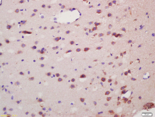 Formalin-fixed and paraffin embedded rat brain labeled with Anti-Spinophilin/Neurabin 2 Polyclonal Antibody, Unconjugated (bs-12146R) at 1:200 followed by conjugation to the secondary antibody and DAB staining