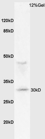 Mouse lung lysates probed with Anti MHC Class II Polyclonal Antibody, Unconjugated (bs-8481R) at 1:200 overnight at 4˚C. Followed by conjugation to secondary antibody (bs-0295G-HRP) at 1:3000 for 90 min at 37˚C. Predicted band 27kD. Observed band size: 30kD
