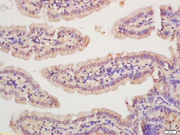 Formalin-fixed and paraffin embedded mouse intestine labeled with Anti-Rad51 Polyclonal Antibody, Unconjugated (bs-10145R) at 1:200 followed by conjugation to the secondary antibody and DAB staining\n