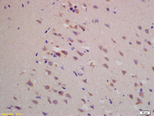 Formalin-fixed and paraffin embedded rat brain labeled with Rabbit Anti BACE1/ASP2 Polyclonal Antibody, Unconjugated (bs-0164R) at 1:200 followed by conjugation to the secondary antibody and DAB staining