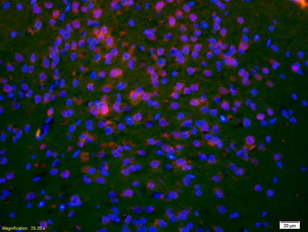 Formalin-fixed and paraffin-embedded rat brain labeled with Anti-DCLREC1C/Artemis Polyclonal Antibody, Unconjugated(bs-12533R) 1:200, overnight at 4°C, The secondary antibody was Goat Anti-Rabbit IgG,Cy3 conjugated(bs-0295G-Cy3)used at 1:200 dilution for 40 minutes at 37°C.\n