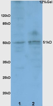 L1 rat brain lysates probed with Anti BACE1/ASP2 Polyclonal Antibody, Unconjugated (bs-0164R) at 1:200 overnight at 4˚C. Followed by conjugation to secondary antibody (bs-0295G-HRP) at 1:3000 for 90 min at 37˚C. Predicted band 51kD. Observed band size:51kD.\n
