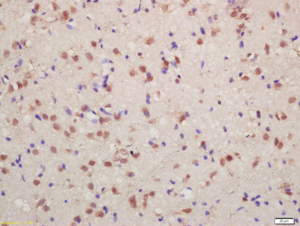 Formalin-fixed and paraffin embedded rat brain labeled with Anti-phospho-FMRP (Ser500) Polyclonal Antibody, Unconjugated (bs-13188R) at 1:200 followed by conjugation to the secondary antibody and DAB staining