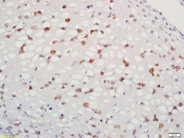 Formalin-fixed and paraffin embedded bone of mouse embryo labeled with Anti-CATSPER Polyclonal Antibody, Unconjugated (bs-2986R) at 1:200 followed by conjugation to the secondary antibody and DAB staining