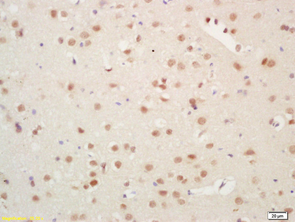Formalin-fixed and paraffin embedded rat brain labeled with  Rabbit Anti Histone H3 Polyclonal Antibody, Unconjugated (bs-0349R) at 1:200 followed by conjugation to the secondary antibody and DAB staining